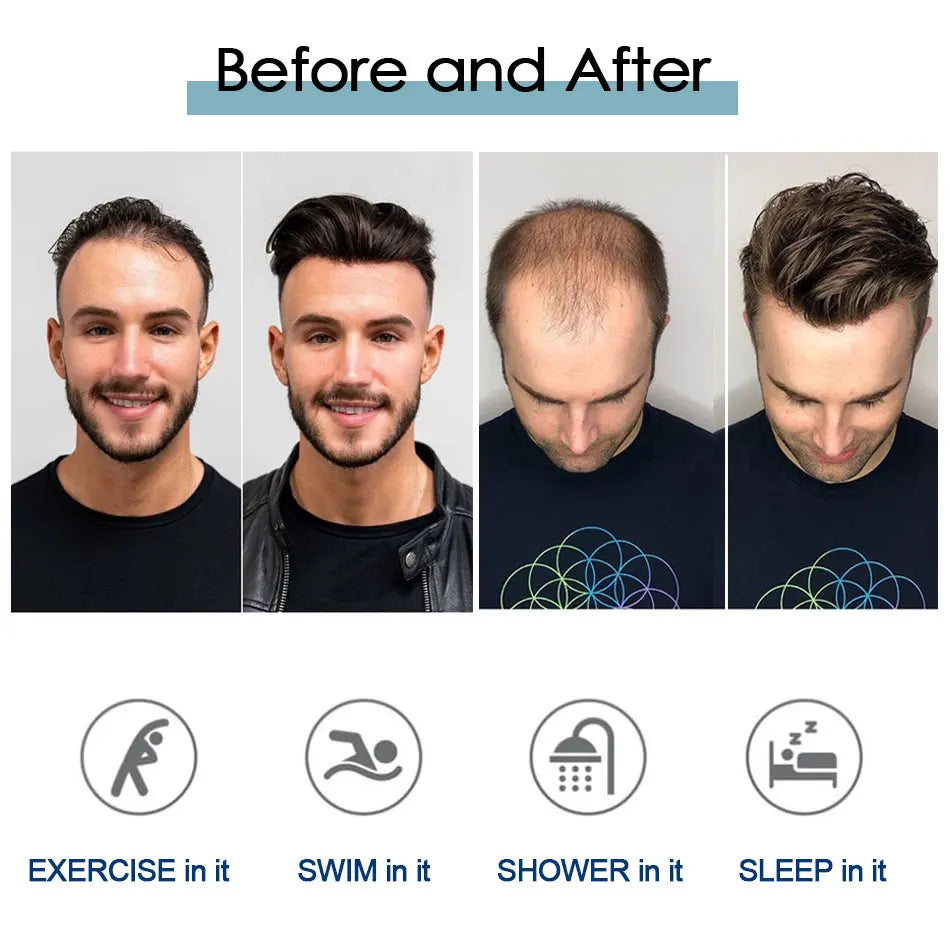 Microskin Hair System for Men | 0.12mm Invisible PU Base | 100% Indian Remy Hair | Knotless Toupee