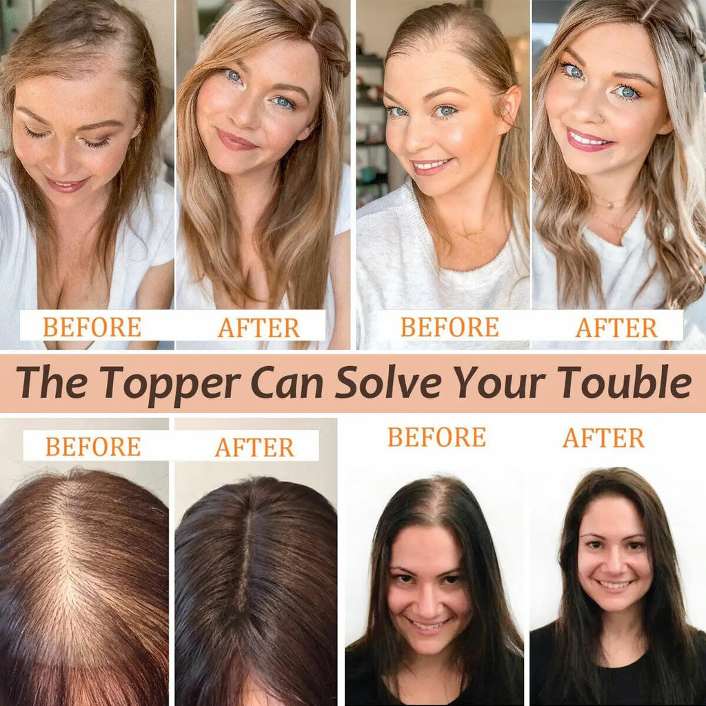 Clip-In Human Hair Topper | 100% Brazilian Remy Hair | Straight 10'' | 7x11cm Silk Base